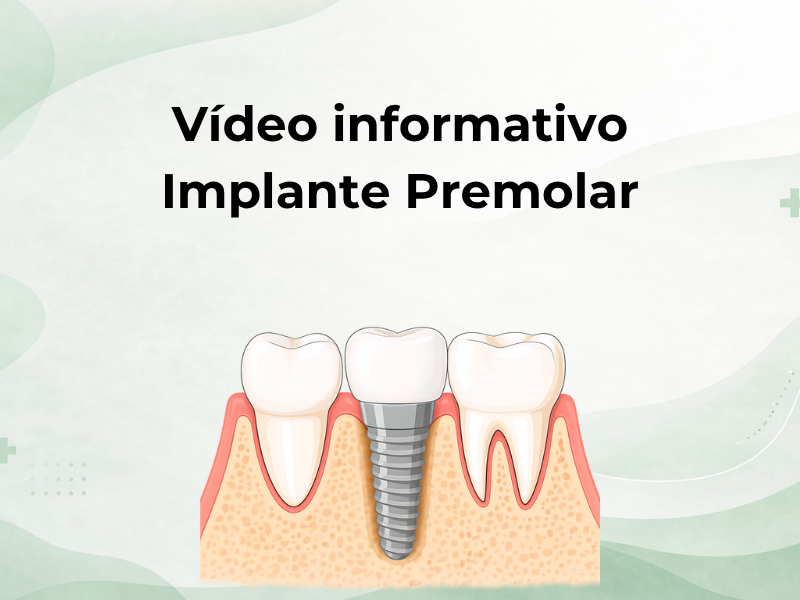 Vídeo informativo sobre implante premolar